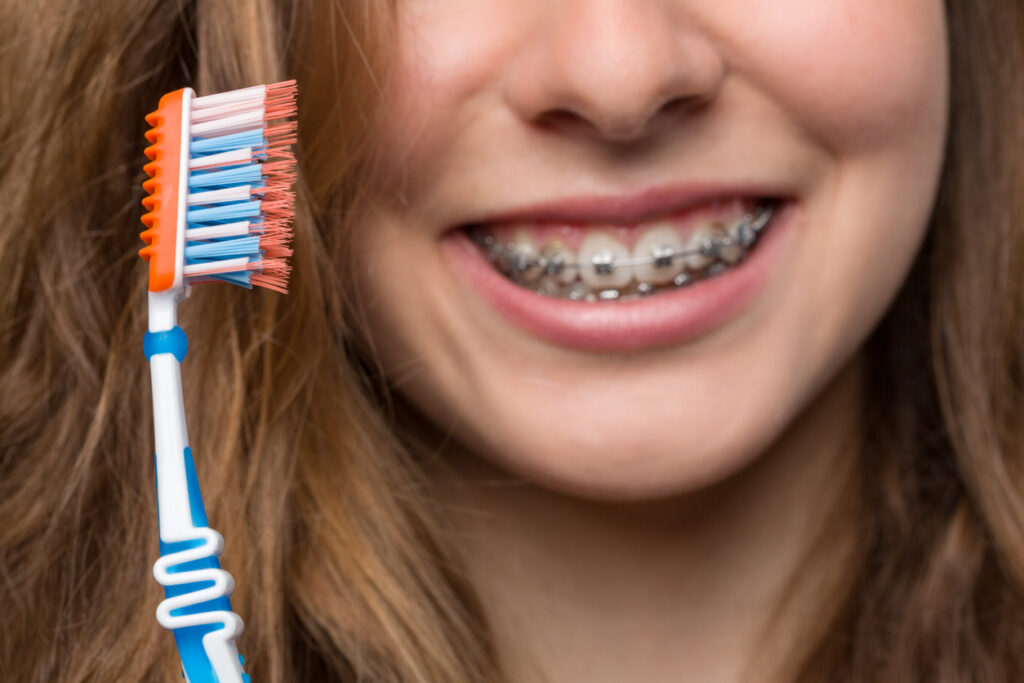 1786110490560 Cleaning And Caring For My Braces