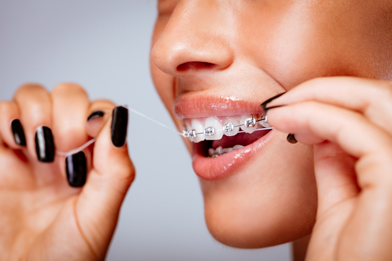 1786110494510 Flossing With Braces