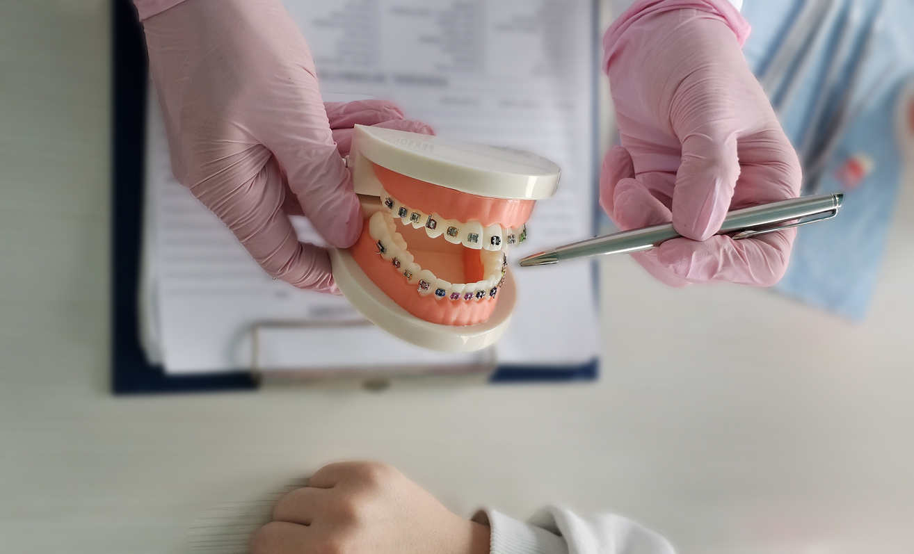 Orthodontist Discussing Orthodontic Model