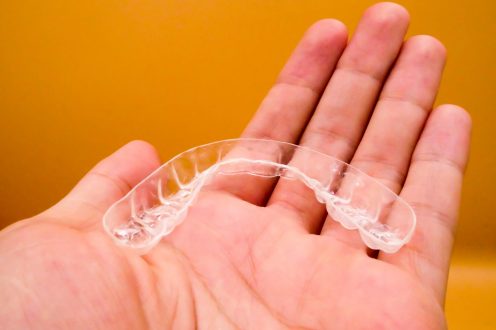 680b1a4bd8b6f092e7c80fc6_holding clear aligners birmingham